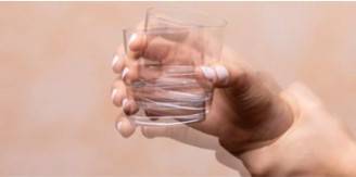 Parkinson's Disease Micro-model 3D Printing Service