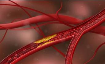 Complex Vascular Micro-model 3D Printing Service