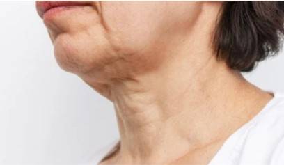 Skin Aging Micro-model 3D Printing Service